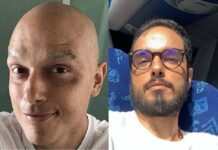 Ator Léo Rosa mostra cabelos crescidos e diz sobre câncer: "Estou curado"