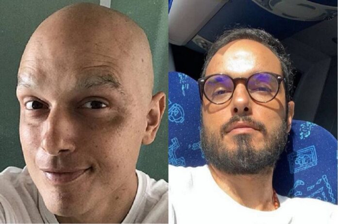 Ator Léo Rosa mostra cabelos crescidos e diz sobre câncer: 